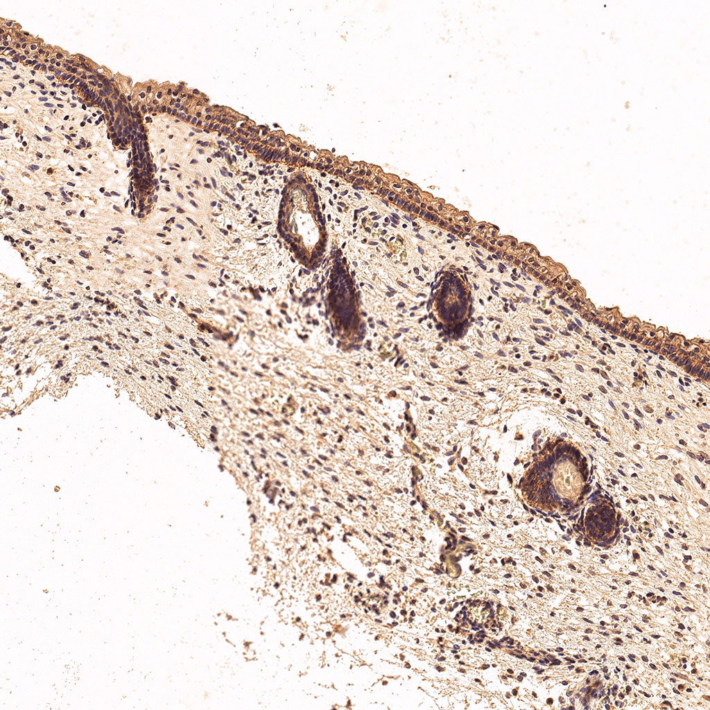 sars-cov-2 gene expression in a human fetus